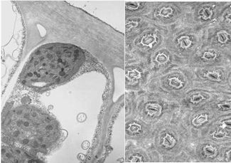 Palisades Cell and Stomata