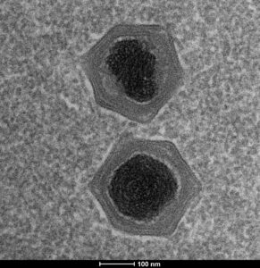 a micrograph image of a virus